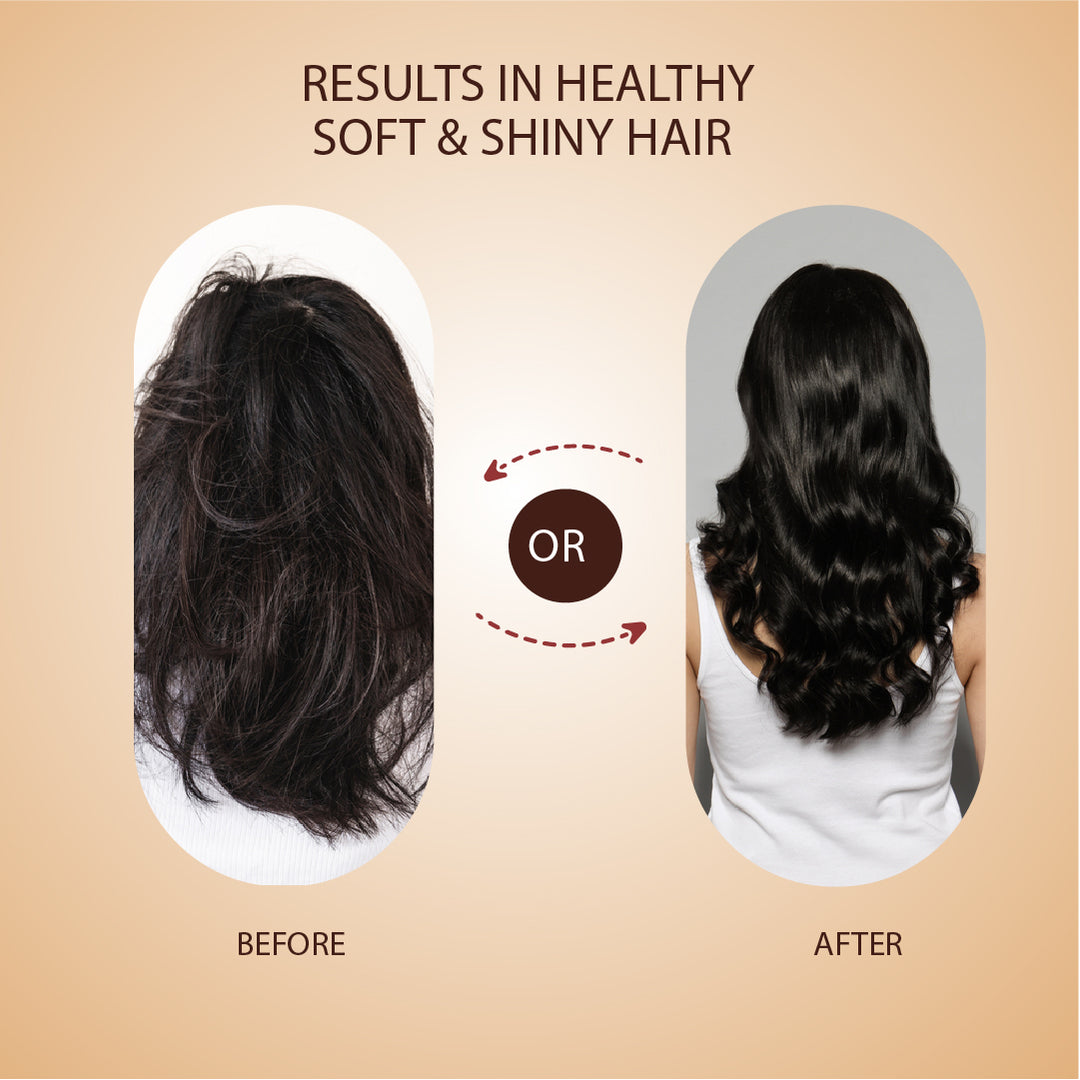 Anti-Hair Fall Tonic For Hair Fall Control & Re-growth -( Net Qty- 100ml)