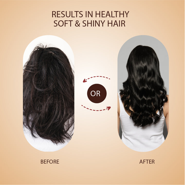 Anti-Hair Fall Tonic For Hair Fall Control & Re-growth -( Net Qty- 100ml)