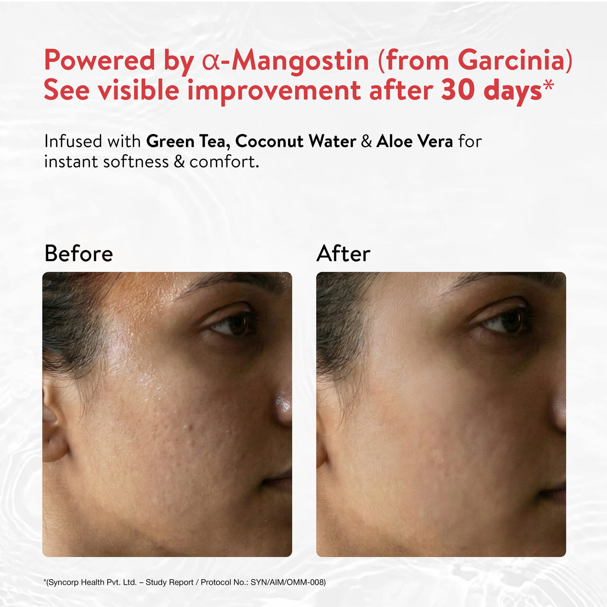 Ayouthveda Oil Control Mattifying Moisturizer Cream | Lightweight Non-Greasy Moisturizer with Green Tea, Aloe Vera & Coconut Water | Controls Excess Oil, Helps Prevent Acne & Gives Long-Lasting Matte Finish | Net Qty - 60g