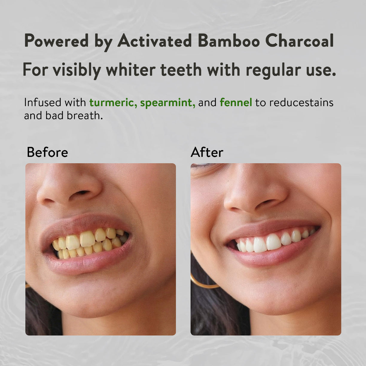 Ayurvedic Charcoal White Toothpaste with Activated Bamboo Charcoal & Turmeric for Deep Cleaning & Whitening  - 100g each (Set of 2)