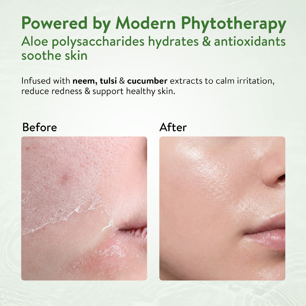 Ayouthveda Aloe Vera Gel | Multi-Purpose Gel For Face, Body & Hair | Calms Sunburn & Promotes Even Skin Tone | Non-Greasy Hydrating formula With Neem, Tulsi & Cucumber Extracts | Net. qty - 150g