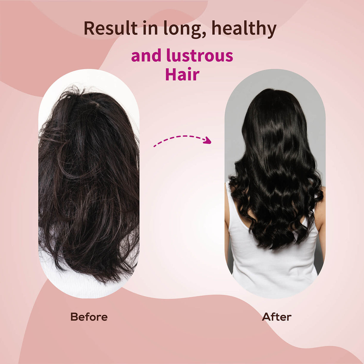 Anti-Hair Fall Shampoo with Onion and Coffee -(Net Qty- 200ml) - Ayouthveda