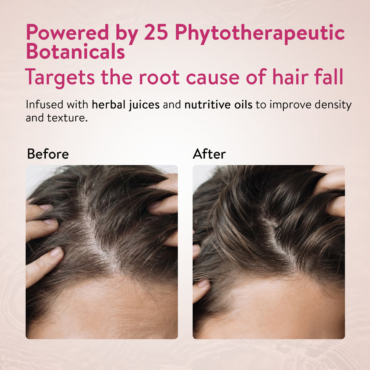Anti-Hair Fall Shampoo with Onion and Coffee -(Net Qty- 200ml)