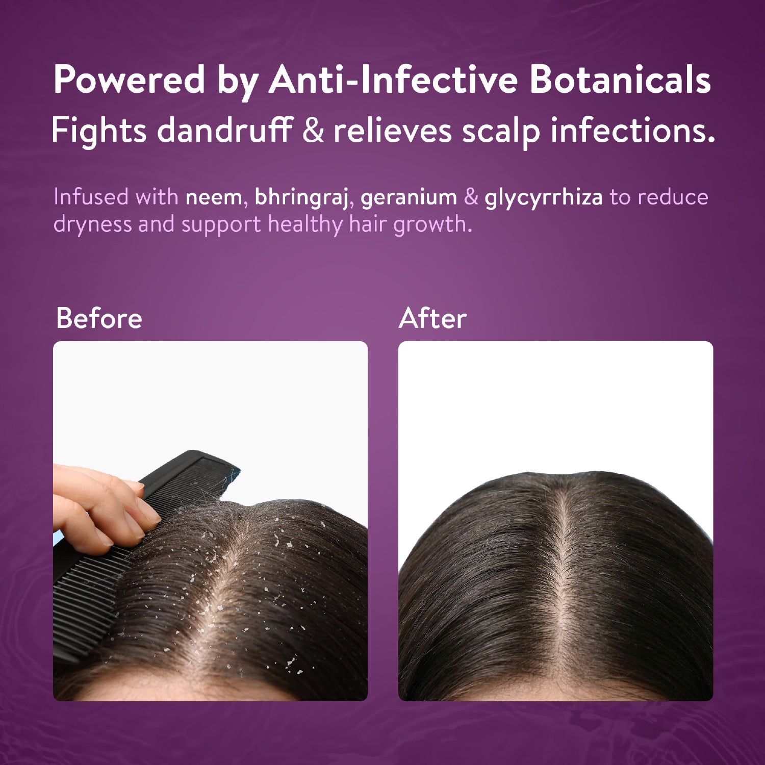 Healthy Hair Shampoo With Bhringraj and Shikakai ( Net Qty- 200ml )
