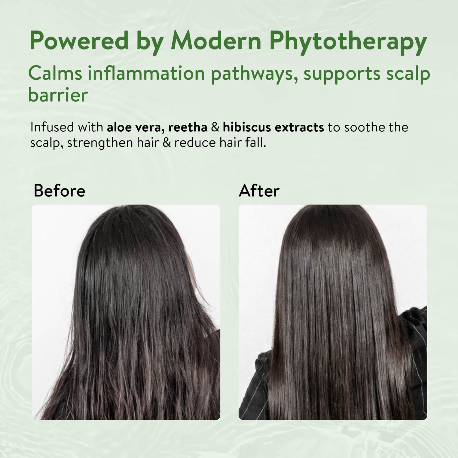 Ayouthveda Aloe Vera Shampoo for Hair Fall, Dandruff & Itchy Scalp | Root-Cause Focused Scalp Care | Phytotherapy-Based Formula | Gentle Cleansing & Scalp-Balancing| Suitable for All Hair Types | Net Qty – 250 ml