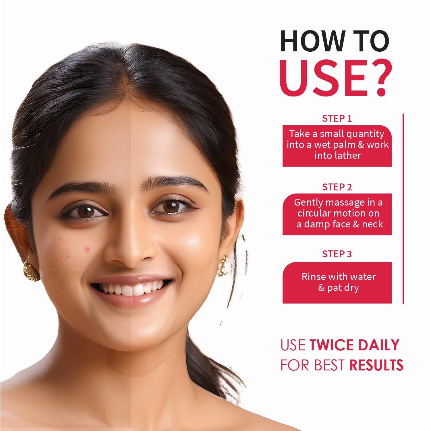 Ayouthveda Acne Enemy Face Wash Gel for Acne & Pimples | Fights Acne-Causing Bacteria & Excess Oil | With Alpha-CURe Complex, Garcinia & Manjistha | Sulfate-Free Gel Cleanser | For Acne-Prone Skin | Net Qty- 100 ml